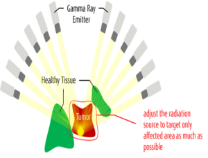 Radiation Treatment for Diseases