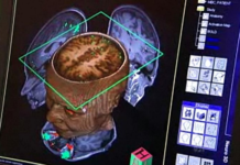 Brain tissue grown on semiconductor chip