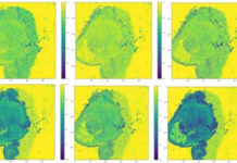 Mid-Infrared, Spectral-Imaging Technique for Medical Diagnostics by CEA-Leti Spectral-Imaging Technique