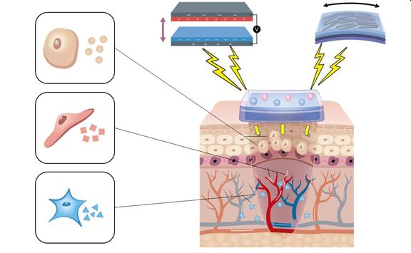 piezoelectric nanogenerators